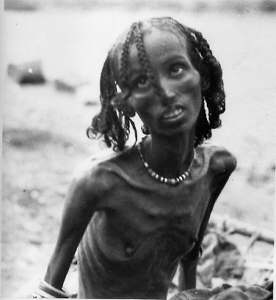 Poverty Picture 31
